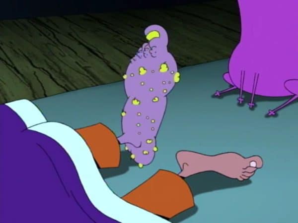 festering-foot